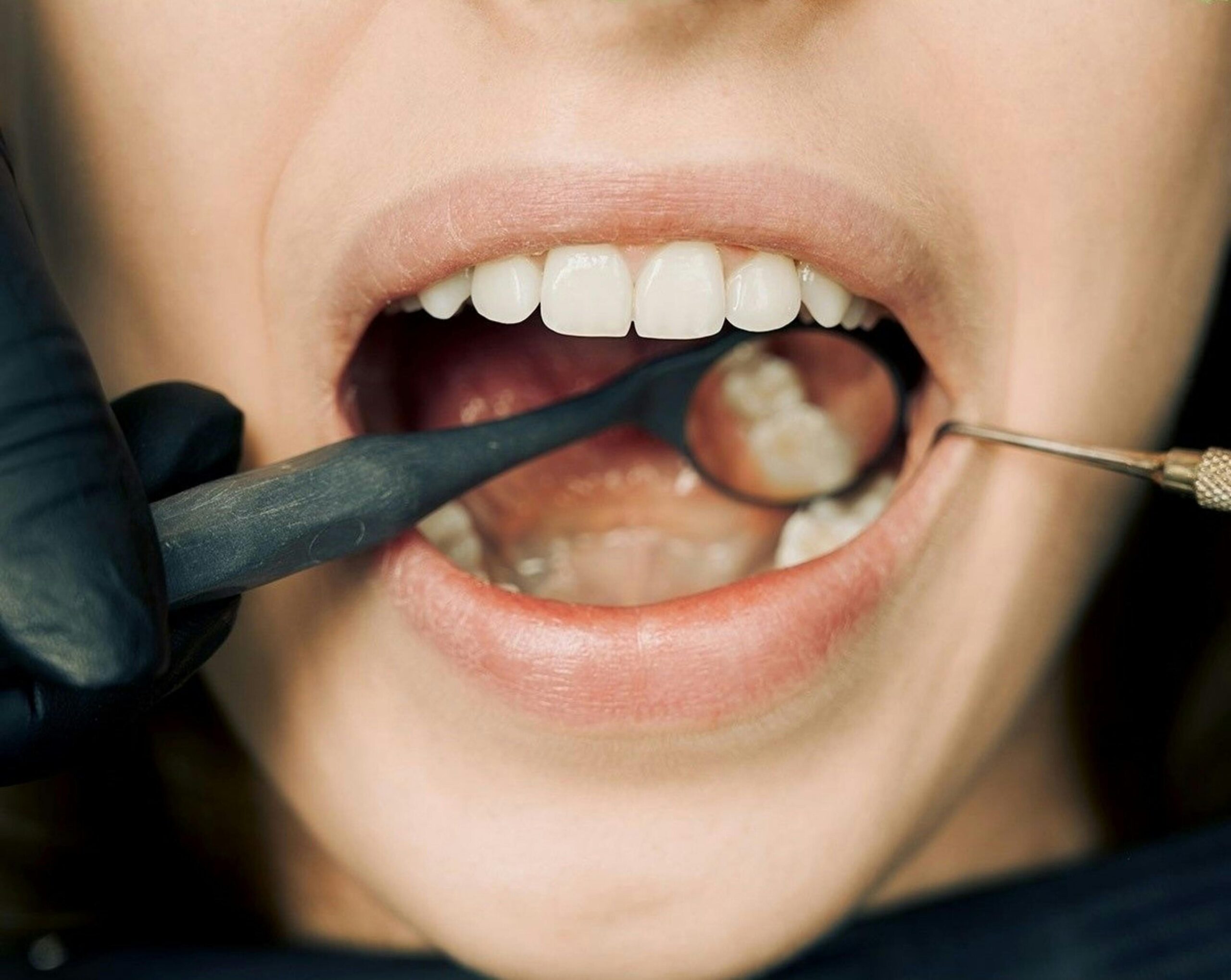 Dental care and smile improvement