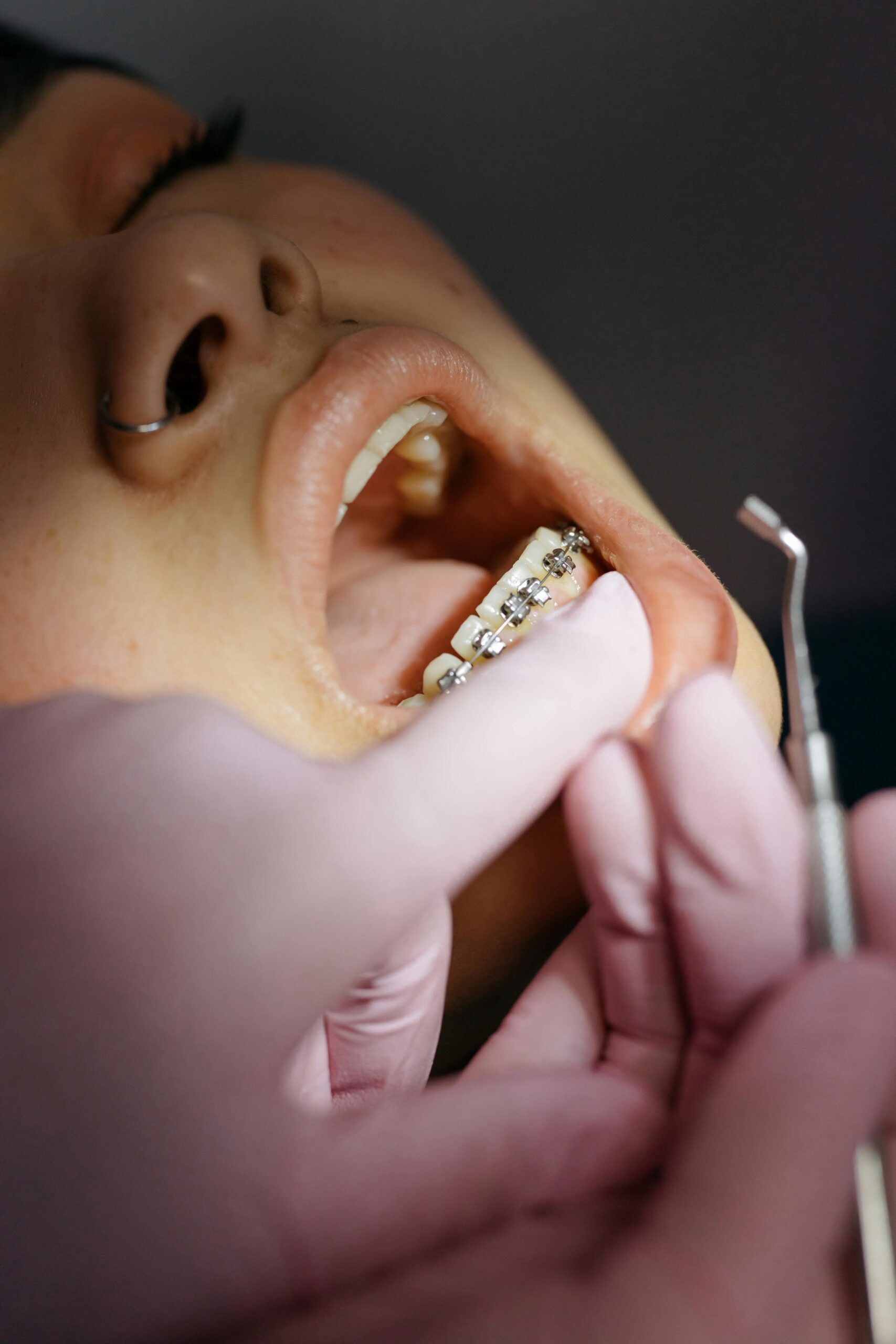 Dental care and orthodontic treatment